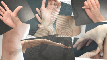 EDSおよびPOTSの治療